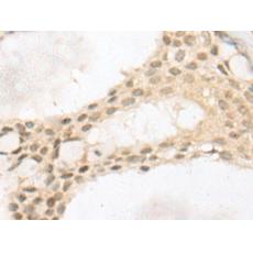 兔抗PNPO多克隆抗體