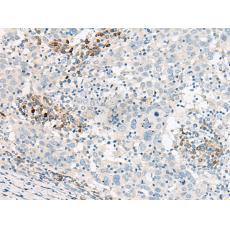 兔抗GUCA1B多克隆抗體 