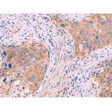兔抗GSPT2多克隆抗體