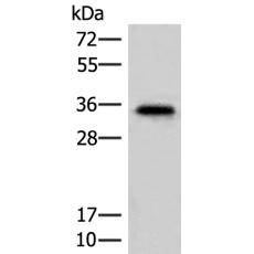 兔抗MS4A1多克隆抗體