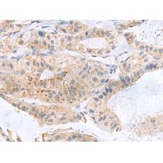 兔抗PHLDA3多克隆抗體