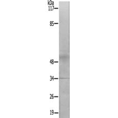 兔抗MRPL4多克隆抗體