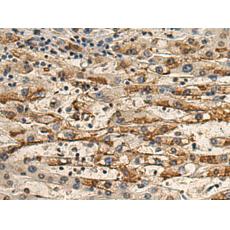  小鼠抗TUBB3單克隆抗體 