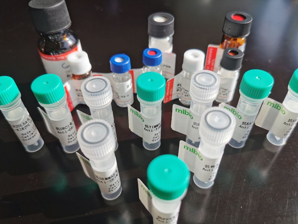 UCHL3抗原（重組蛋白）