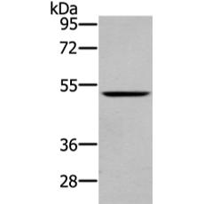 兔抗WASF2多克隆抗體 