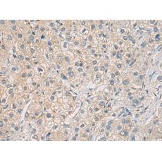 兔抗WFDC3多克隆抗體  