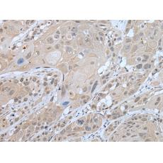 兔抗WFS1多克隆抗體  