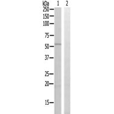  兔抗WIPF1多克隆抗體  